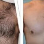 Masajes y Estética masculina