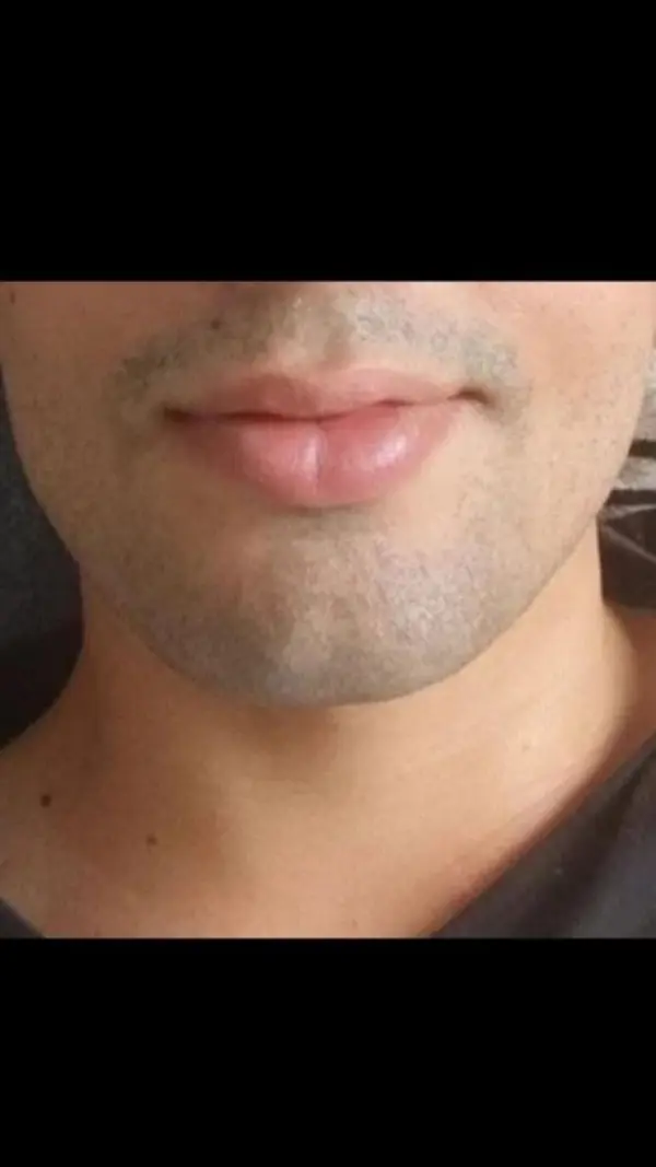 Fondo avatar